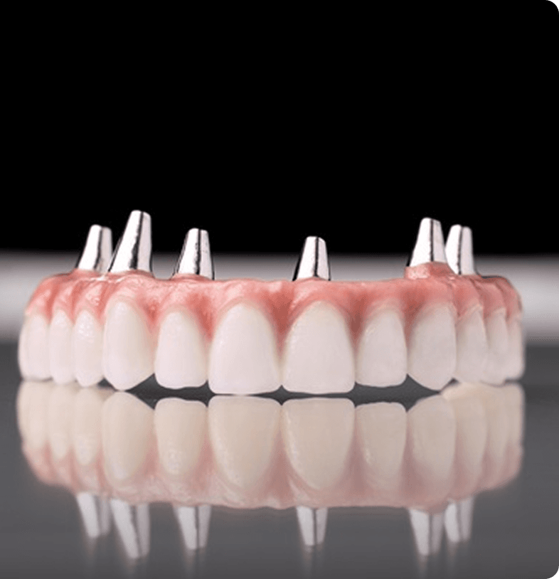 Dental Crown Types