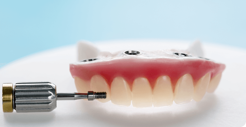 Happy patient pointing to smile