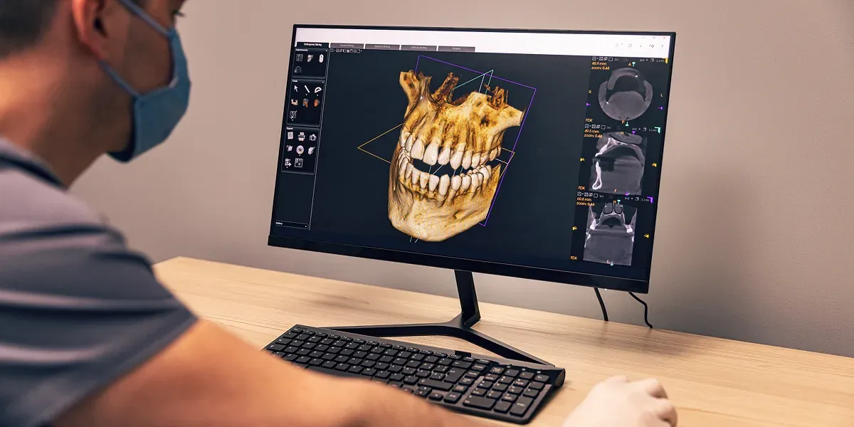 How 3D Digital Scanning Improves Precision in Oral and Facial Surgery